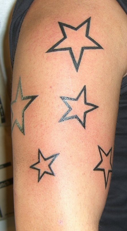 Multi-star design on the arm