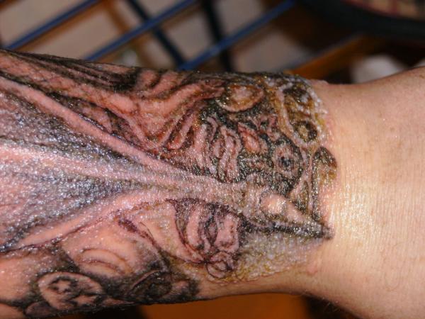 How to cure an infected tattoo - How to know if a tattoo is infected - symptoms